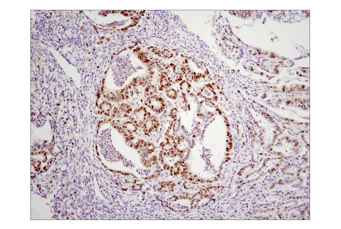 Immunohistochemistry Image 2: Ki-67 (8D5) Mouse Monoclonal Antibody (BSA and Azide Free)