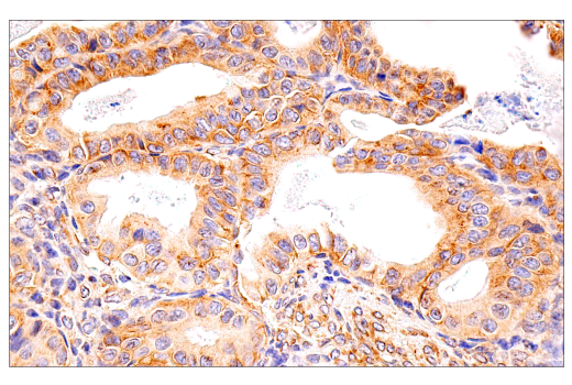 Immunohistochemistry Image 6: G3BP1 (E9G1M) Rabbit Monoclonal Antibody