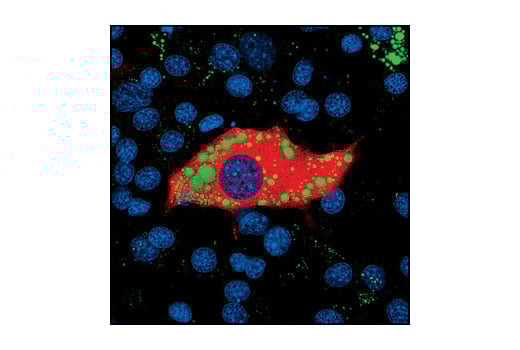 Immunofluorescence Image 1: ATGL (30A4) Rabbit Monoclonal Antibody (BSA and Azide Free)
