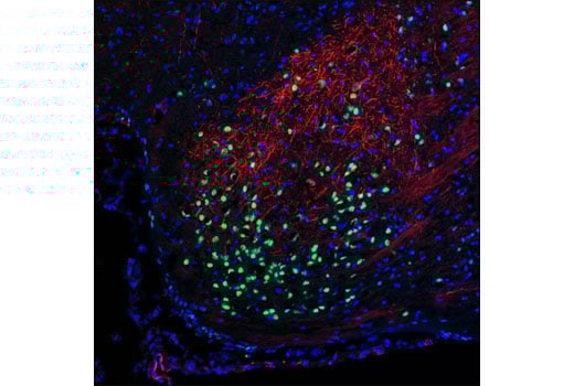 Immunofluorescence Image 1: Thyroid Transcription Factor 1 (TTF-1) (D2E8) Rabbit Monoclonal Antibody (BSA and Azide Free)