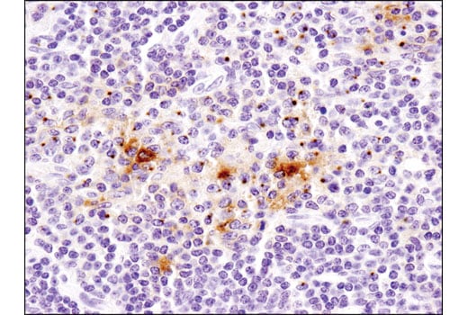 Immunohistochemistry Image 1: CD40 Ligand (D5J9Y) Rabbit Monoclonal Antibody