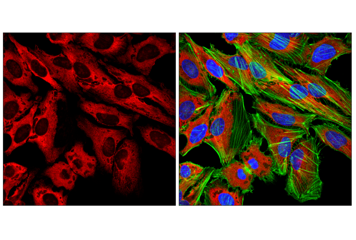 Immunofluorescence Image 1: Goat Anti-Rabbit IgG (H+L) Antibody (Alexa Fluor<sup>®</sup> 568 Conjugate)