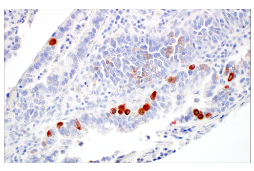 Immunohistochemistry Image 4: GUCY2C (E6I2U) Rabbit Monoclonal Antibody