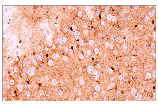 Immunohistochemistry Image 1: S100B (E9F2I) Rabbit Monoclonal Antibody (BSA and Azide Free)