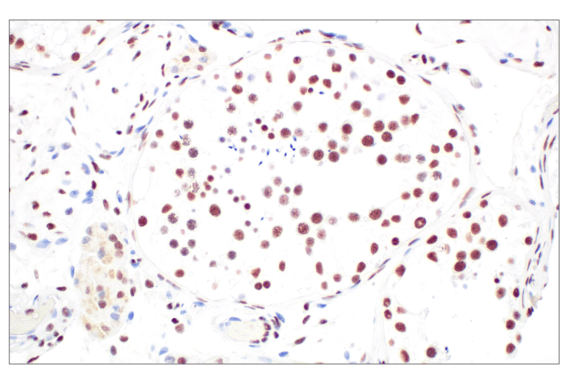 CBX7 (E7N1W) Rabbit mAb | Cell Signaling Technology