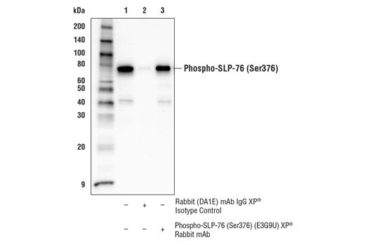 Immunoprecipitation Image 1: Phospho-SLP-76 (Ser376) (E3G9U) Rabbit Monoclonal Antibody