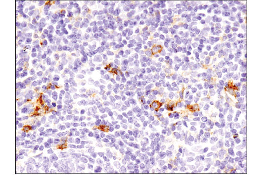 Immunohistochemistry Image 1: TIM-3 (D5D5R<sup>™</sup>) Rabbit Monoclonal Antibody