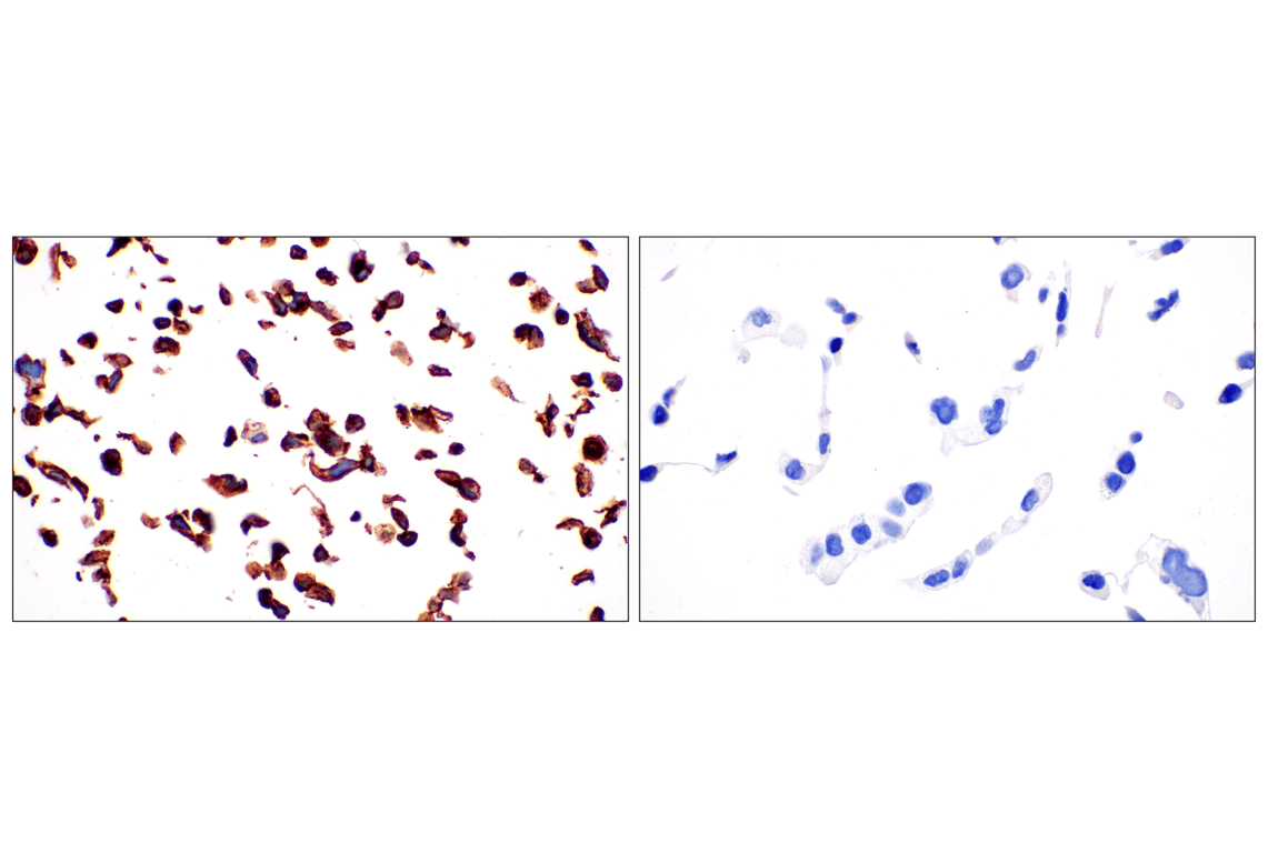 Immunohistochemistry Image 10: MCT1/SLC16A1 (E7A2K) Rabbit Monoclonal Antibody