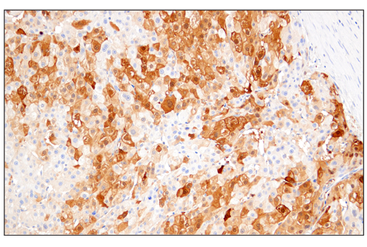Immunohistochemistry Image 1: Arginase-1 (E4U1I) Mouse Monoclonal Antibody
