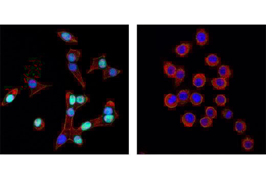 Immunofluorescence Image 1: Pdx1 (D59H3) Rabbit Monoclonal Antibody (BSA and Azide Free)