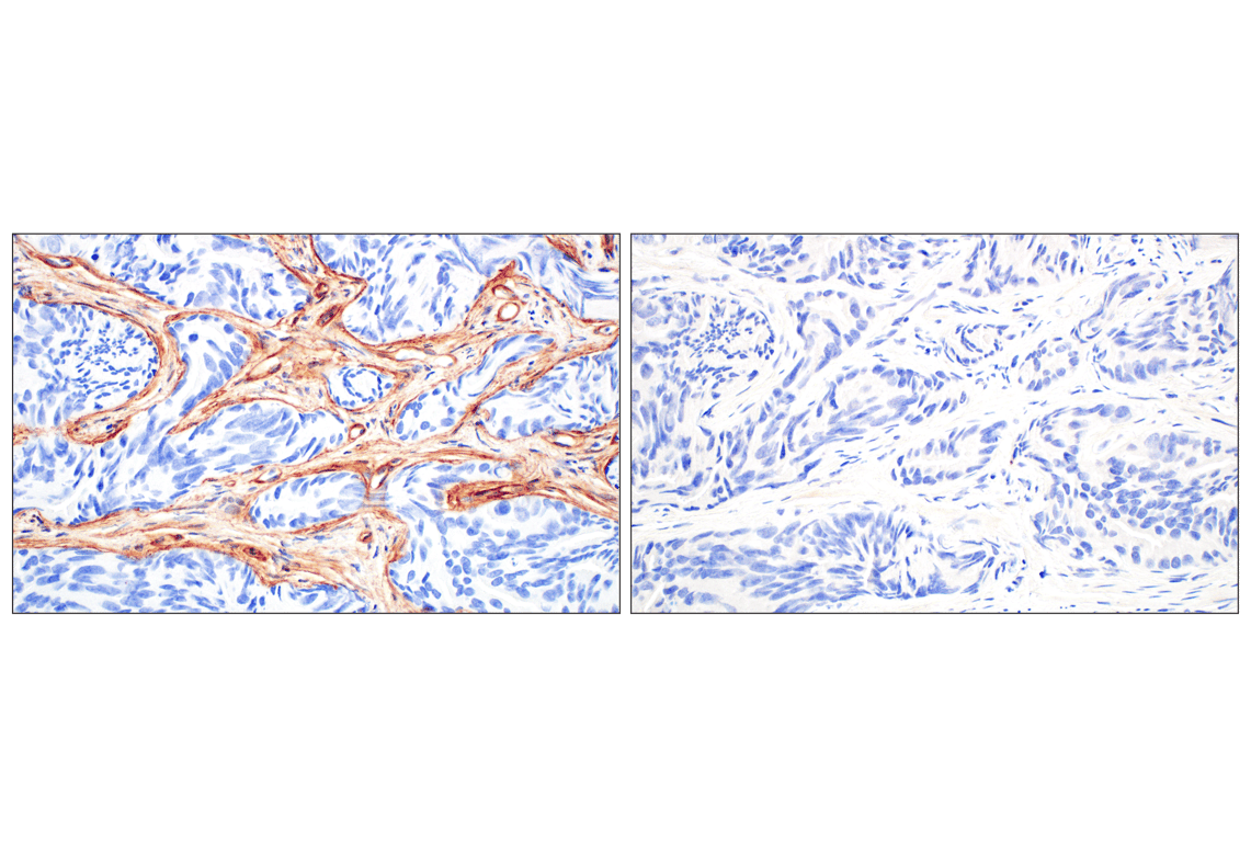 Immunohistochemistry Image 8: COL4A1 (E5M6R) Rabbit Monoclonal Antibody (IHC Formulated)