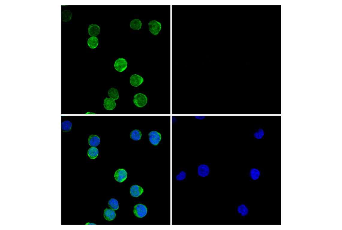 Immunofluorescence Image 1: Zap-70 (D1C10E) Rabbit Monoclonal Antibody (BSA and Azide Free)