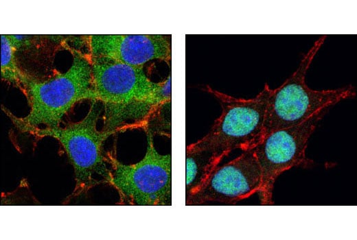 Immunofluorescence Image 1: FoxO3a (75D8) Rabbit Monoclonal Antibody