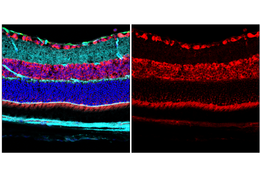 Immunofluorescence Image 3: YTHDF2 (E2I2H) Rabbit mAb