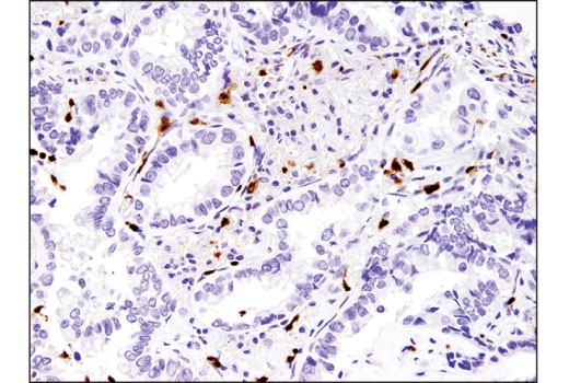 Immunohistochemistry Image 3: Arginase-1 (D4E3M<sup>™</sup>) Rabbit Monoclonal Antibody