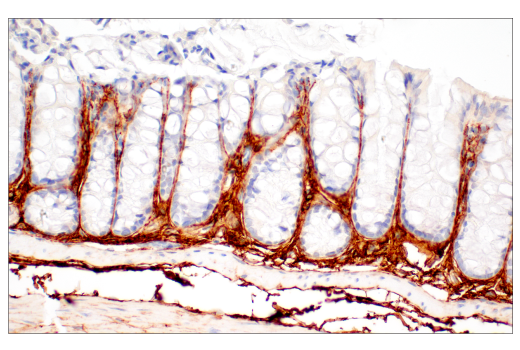 Immunohistochemistry Image 5: EphA2 (D4A2) Rabbit Monoclonal Antibody