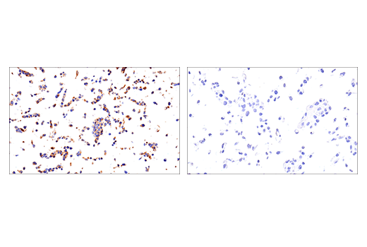 undefined Image 22: ECM Profiling Antibody Sampler Kit
