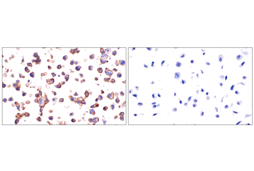 Immunohistochemistry Image 5: CD4 (EP204) Rabbit Monoclonal Antibody