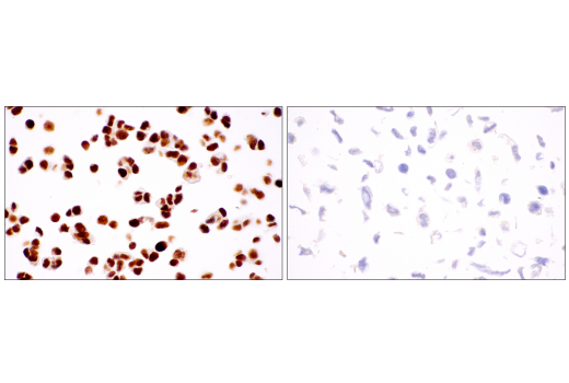 Immunohistochemistry Image 7: ATRX (E5X7O) Rabbit Monoclonal Antibody