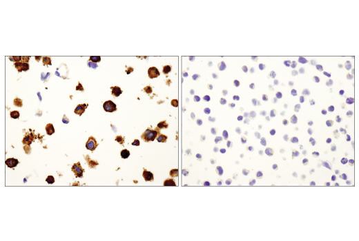 Immunohistochemistry Image 4: Vinculin (E1E9V) Rabbit Monoclonal Antibody (BSA and Azide Free)