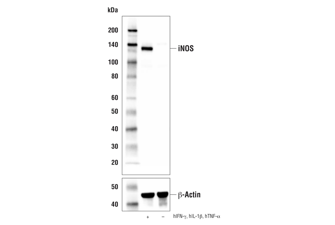 Western Blotting Image 1: iNOS (E2M9F) Rabbit mAb