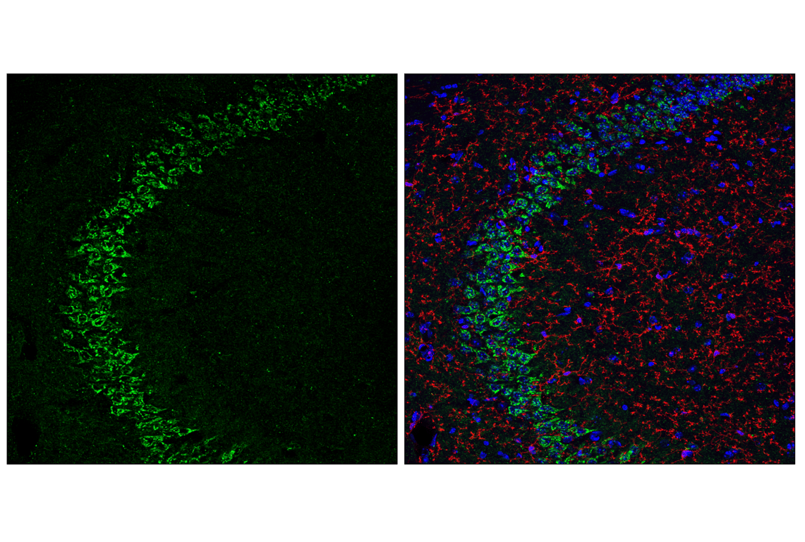 Immunofluorescence Image 1: ITM2C/Bri3 (F3X8Z) Rabbit Monoclonal Antibody