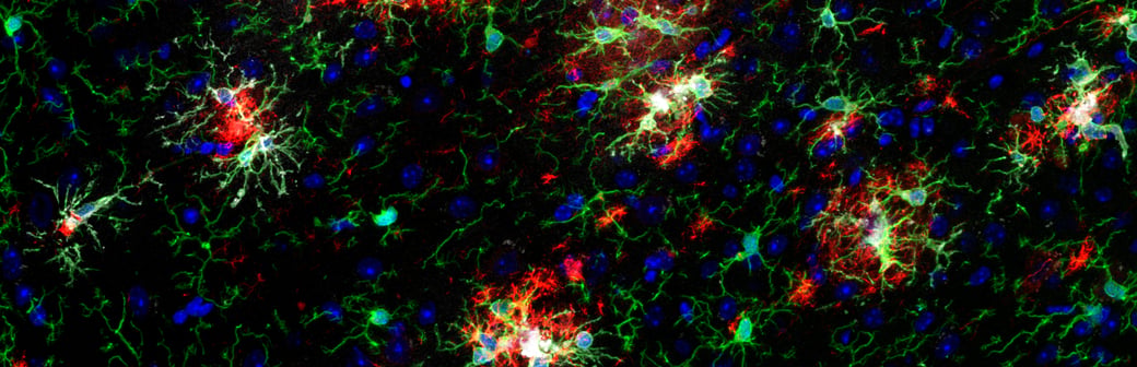 Iba1/AIF-1 (E4O4W) XP® Mouse Chimeric mAb