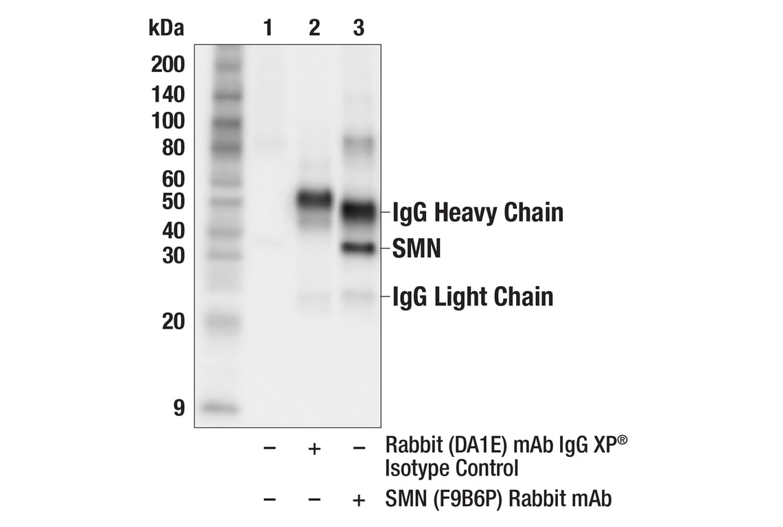 Immunoprecipitation Image 1: SMN (F9B6P) Rabbit Monoclonal Antibody