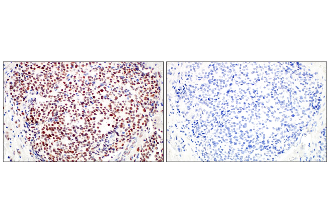 Immunohistochemistry Image 15: TLE3 (E4F3Y) Rabbit Monoclonal Antibody