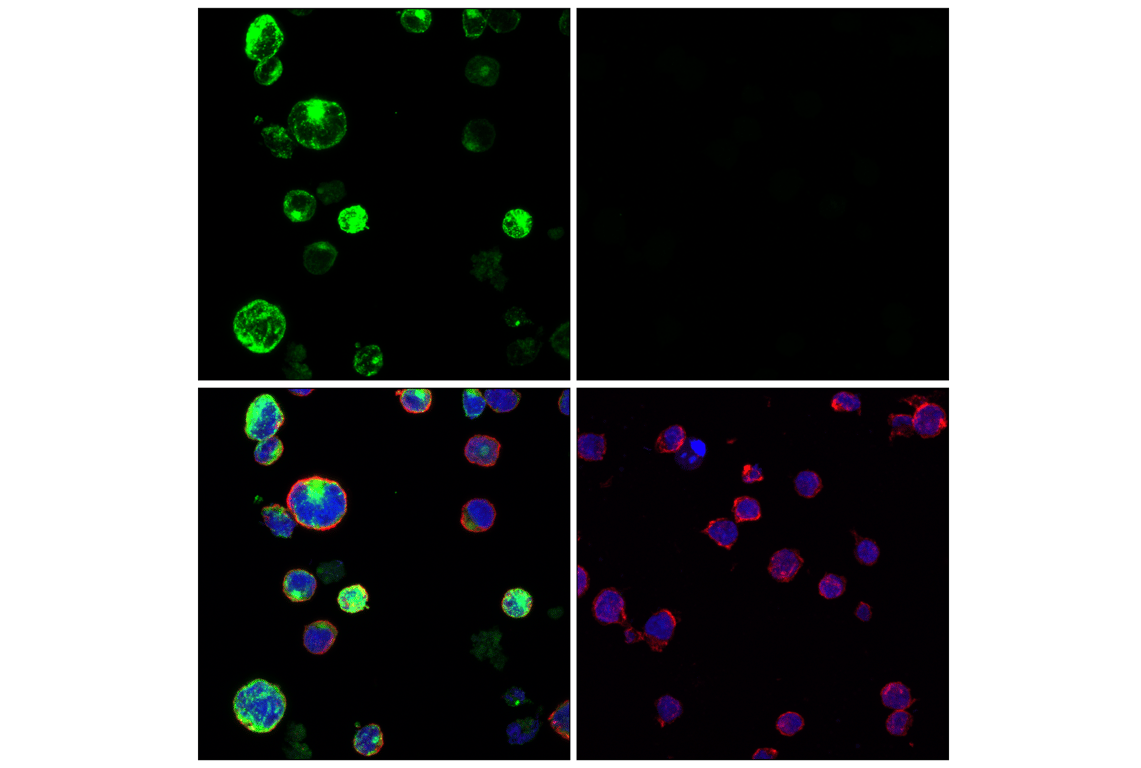 Immunofluorescence Image 1: GNLY (E3N1M) Rabbit Monoclonal Antibody