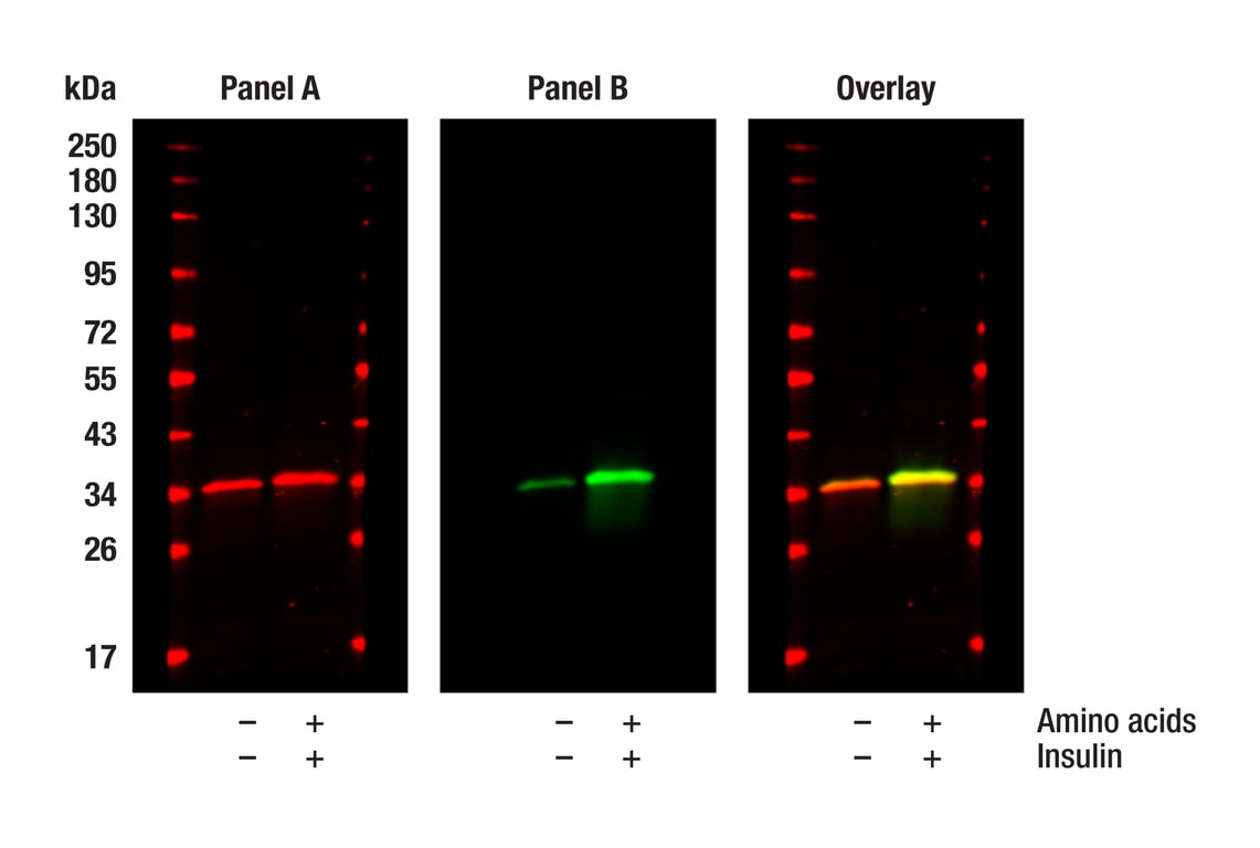 Western Blotting Image 1: Phospho-S6 Ribosomal Protein (Ser240/244) (D68F8) Rabbit Monoclonal Antibody