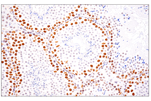 Immunohistochemistry Image 7: SETD2 (E4W8Q) Rabbit Monoclonal Antibody (IHC Formulated)