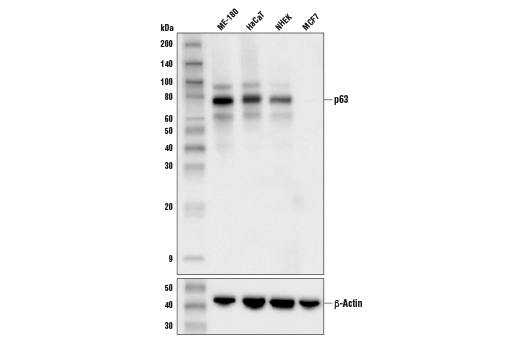 Western Blotting Image 1: p63 (D9L7L) XP<sup>®</sup> Rabbit mAb