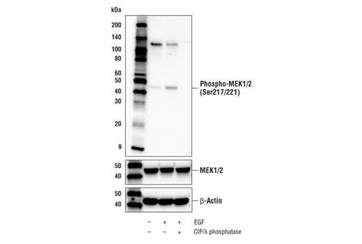 Western Blotting Image 3: Phospho-MEK1/2 (Ser217/221) (E4M5C) Rabbit Monoclonal Antibody