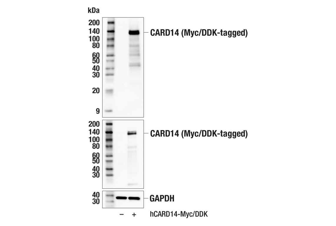 Western Blotting Image 2: CARD14 (E3F8E) Rabbit Monoclonal Antibody