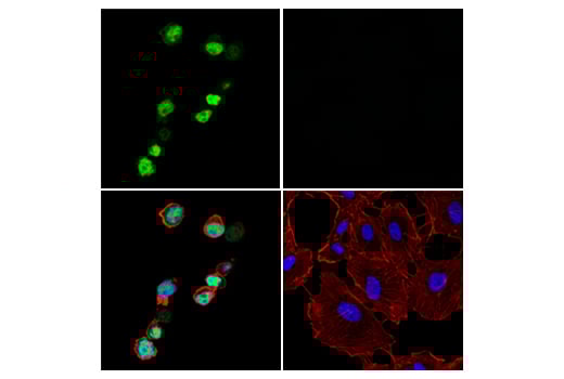 Immunofluorescence Image 1: Tox/Tox2 (E6G5O) Rabbit Monoclonal Antibody (BSA and Azide Free)