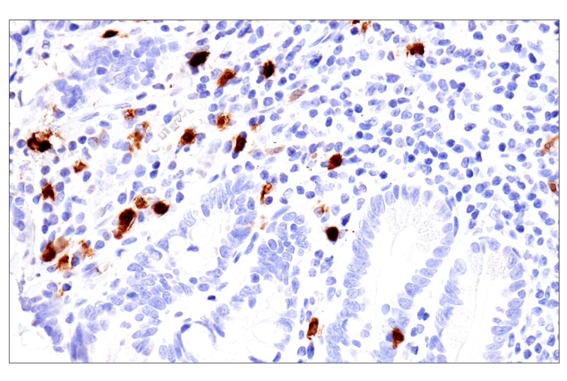 Immunohistochemistry Image 9: S100A8 (F4R2W) Rabbit Monoclonal Antibody (BSA and Azide Free)