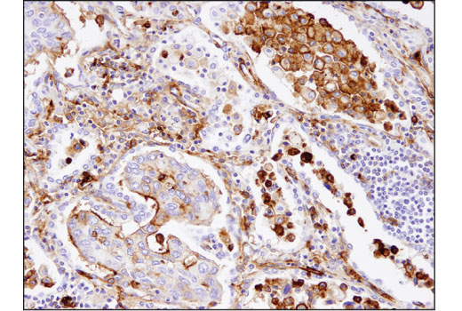 Immunohistochemistry Image 2: CD13/APN (D6V1W) Rabbit Monoclonal Antibody (BSA and Azide Free)