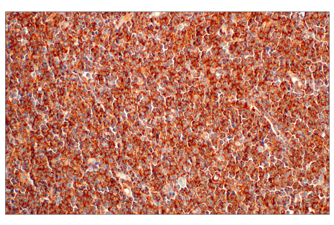 Immunohistochemistry Image 3: EEA1 (E9Q6G) Mouse Monoclonal Antibody