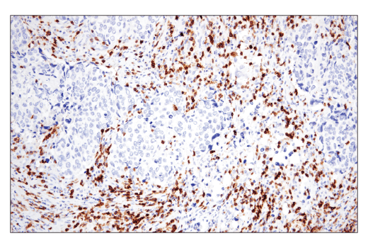 Immunohistochemistry Image 4: CD6 (E9Y7Y) Rabbit Monoclonal Antibody