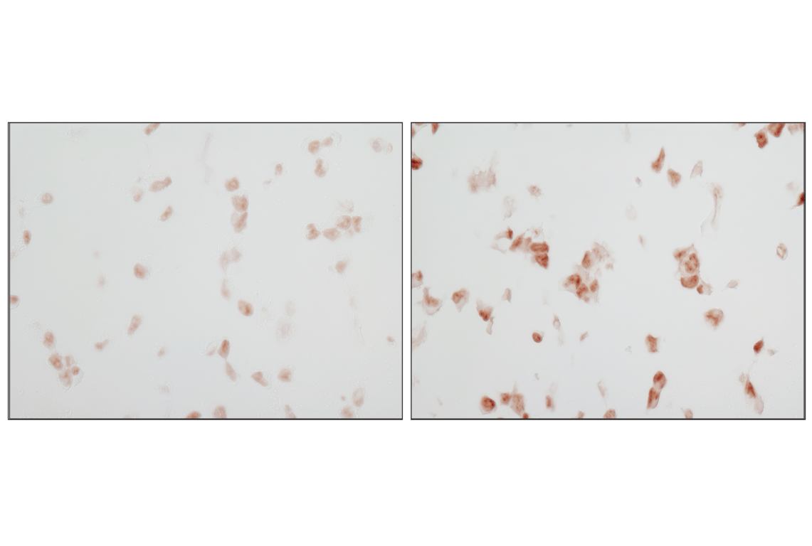 Immunohistochemistry Image 3: Phospho-p38 MAPK (Thr180/Tyr182) (D3F9) Rabbit Monoclonal Antibody