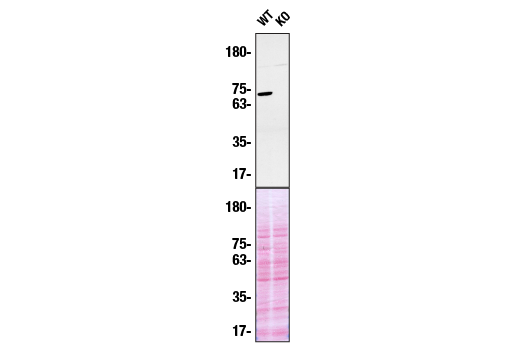 Western Blotting Image 2: Syk (D1I5Q) Rabbit Monoclonal Antibody (BSA and Azide Free)