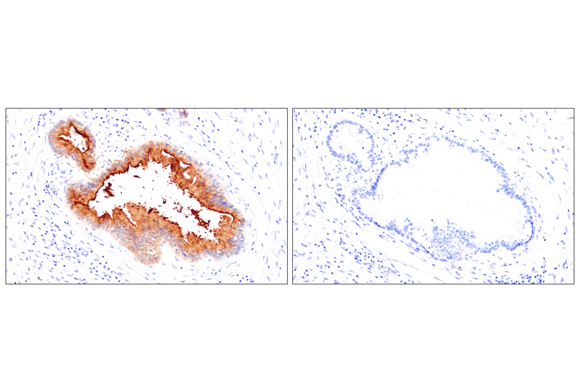 Immunohistochemistry Image 11: CEACAM7 (E5Q6X) Rabbit Monoclonal Antibody