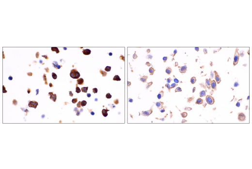 Immunohistochemistry Image 3: MYPT1 (D6C1) Rabbit Monoclonal Antibody (BSA and Azide Free)