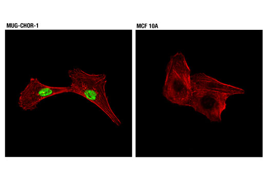 好評 Brachyury (D2Z3J) Rabbit mAb (#81694) Datasheet With Images テープ・マスキングテープ