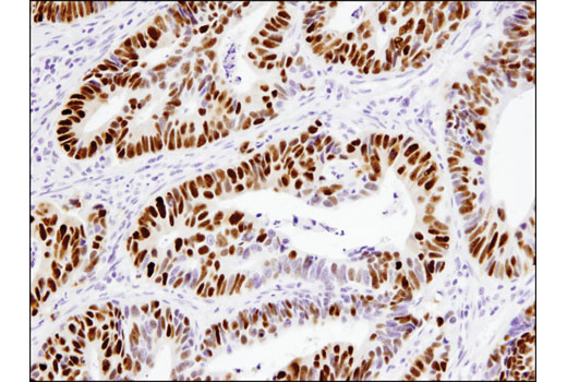 Immunohistochemistry Image 1: p53 (DO-7) Mouse Monoclonal Antibody (BSA and Azide Free)