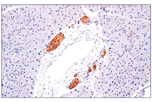 Immunohistochemistry Image 6: Enolase-2 (E2H9X) Rabbit Monoclonal Antibody (BSA and Azide Free)