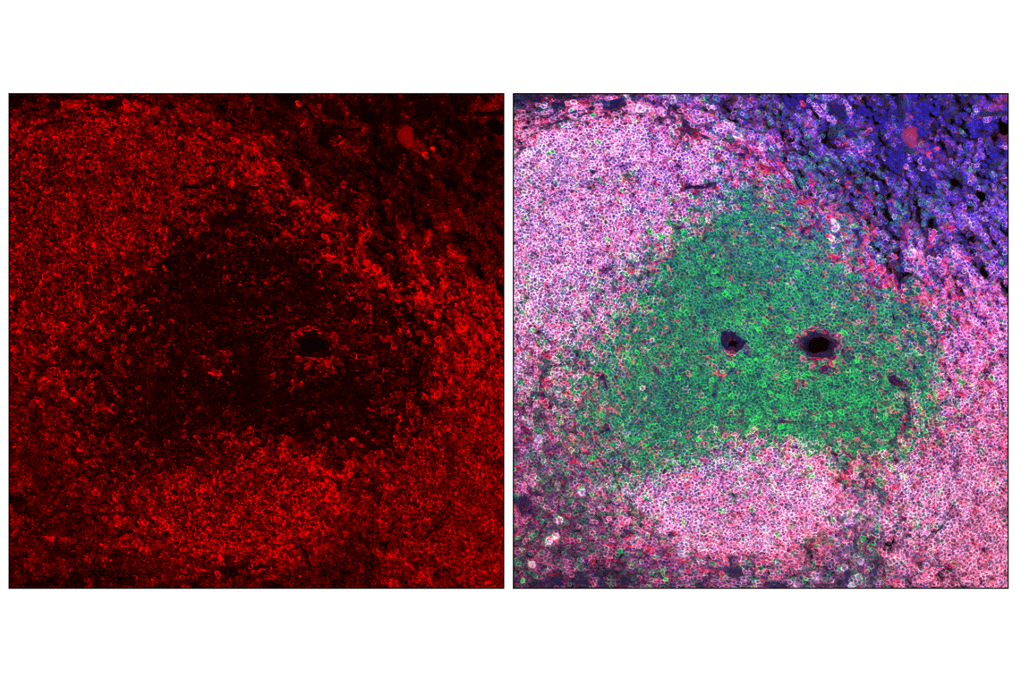 Immunofluorescence Image 1: PLCγ2 (F9L8Z) Rabbit mAb