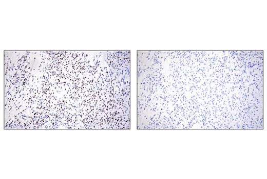 Immunohistochemistry Image 6: ZEB1 (E2G6Y) Rabbit Monoclonal Antibody (BSA and Azide Free)