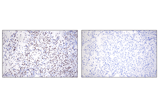 Immunohistochemistry Image 6: ZEB1 (E2G6Y) XP<sup>®</sup> Rabbit mAb (BSA and Azide Free)